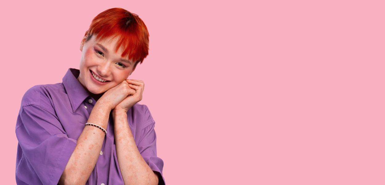 visibilidade trans Allya